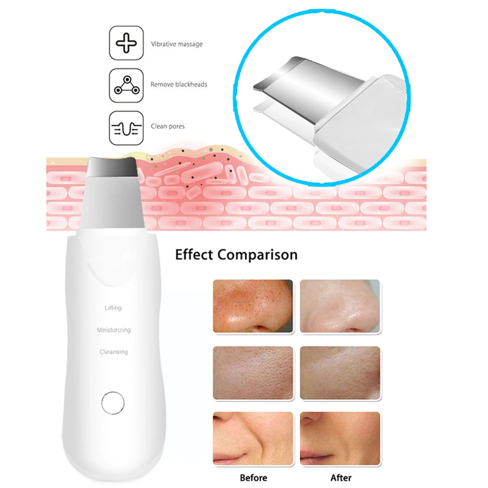 ZenGlow™ Ultrasonic Facial Skin Scrubber & Pore Cleaner